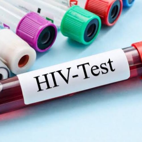Kabale district registers 653 fresh HIV Infections